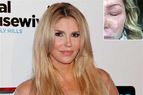 Brandi Glanville Before And After