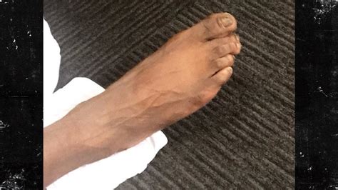 NBA's Reggie Jackson Reveals Jacked Up Feet!