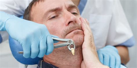 10 Best Tips To Prevent Wisdom Tooth Extraction Complications