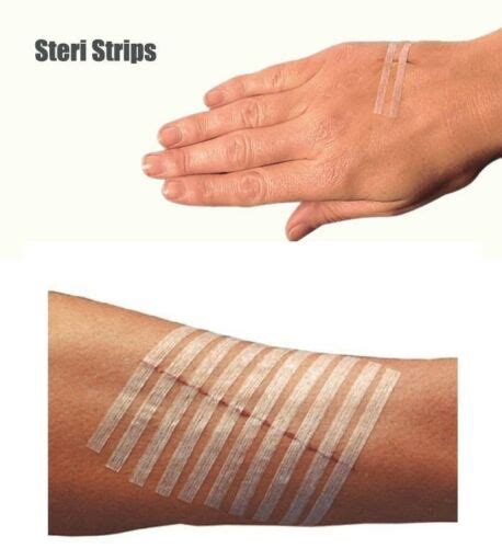 wound closure tape skin adhesive strips for wounds