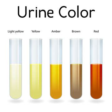 4,141 BEST Urine Color IMAGES, STOCK PHOTOS & VECTORS | Adobe Stock