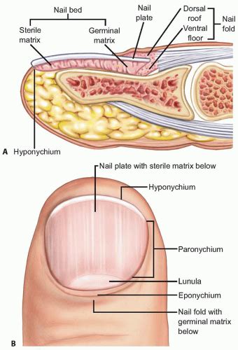 Nail Matrix Repair, Reconstruction, and Ablation | Musculoskeletal Key