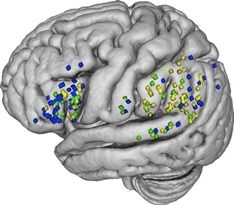 Mapping the brain network of the phonological loop - Papagno - 2017 - Human Brain Mapping ...