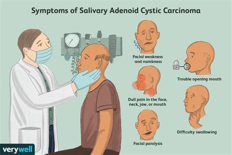 Adenoid Face Before And After