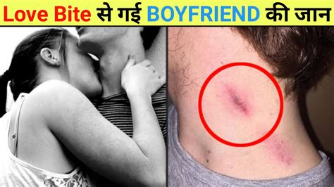 Love Bite देने से पहले इस video को ज़रूर देखे | Watch this video before giving love bite ...