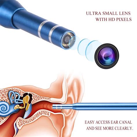 3 in 1 Ear Cleaning Endoscope High Definition Visual Earpick Ear Spoon ...