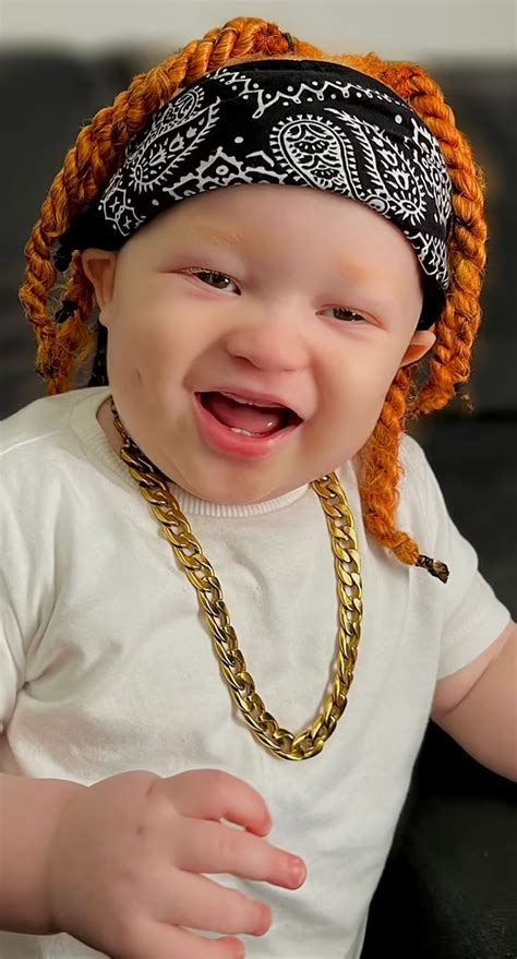 Black Mom Gives Birth To Adorable Albino Baby With Ginger Hair - Small Joys