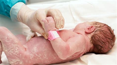 Vernix caseosa : à quoi sert cette substance chez le bébé ? | PARENTS.fr