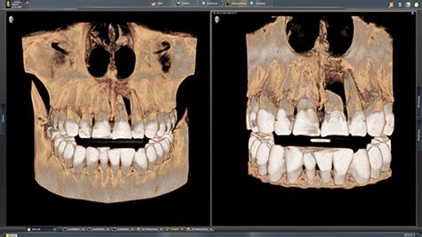 Sidexis 4: The Software for the Optimal Networking of Imaging Systems in the Practice - Oral ...