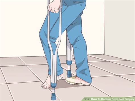 How to Recover From Foot Surgery (with Pictures) - wikiHow