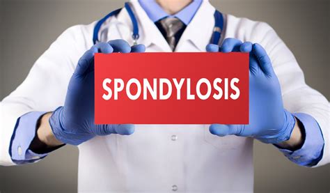 10 Symptoms of Ankylosing Spondylitis - Facty Health
