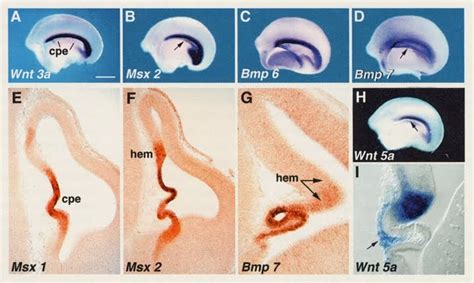 Cortical Hemming and Hawing: Cortical Hem...ing and Hawing