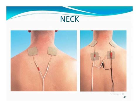 Interferential therapy