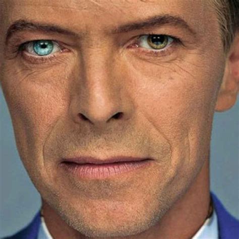Il mistero degli occhi di colore diverso di David Bowie, ecco il motivo (David Bowie)