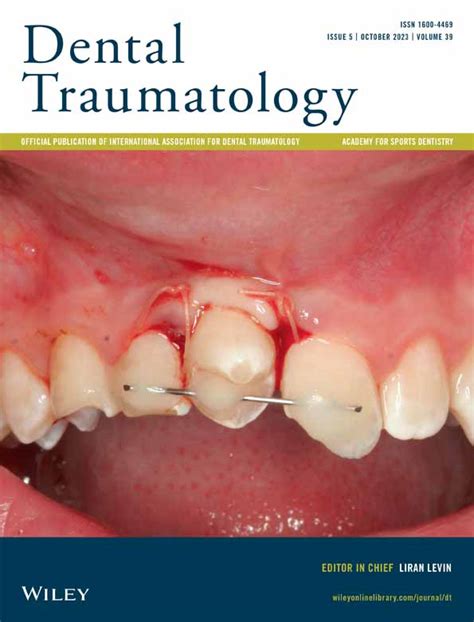 Dental Traumatology: Vol 39, No 5