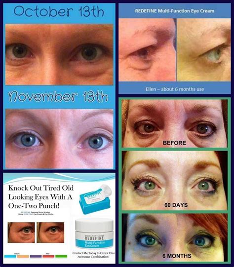 Non-surgical eye bag removal! A product that is clinically proven to ...