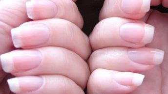 What Causes Dents in Fingernails? - Remedies Lore