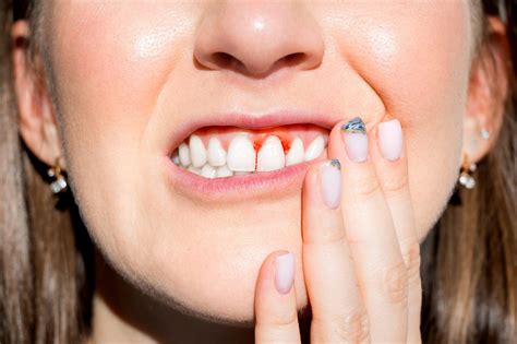 What Does Gum Disease Look Like | Peel Dental Studio Dentist Mandurah