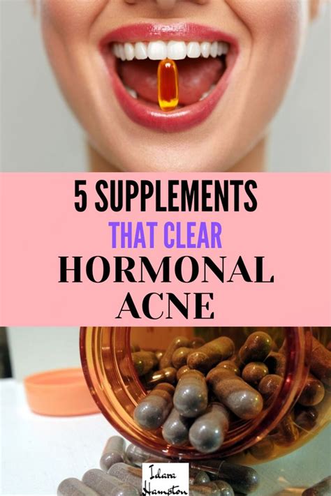 Is hormonal acne driving you crazy? I'm going to share five of my ...