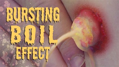 Bursting Boil: Practical Special Effects Tutorial - YouTube