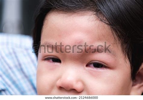 Head Injury Children Photos and Images | Shutterstock