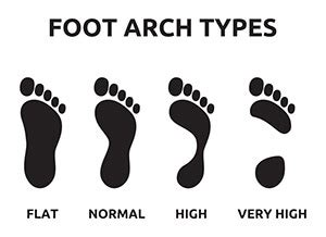 Foot Arch Types: What You Need To Know | FootGearLab