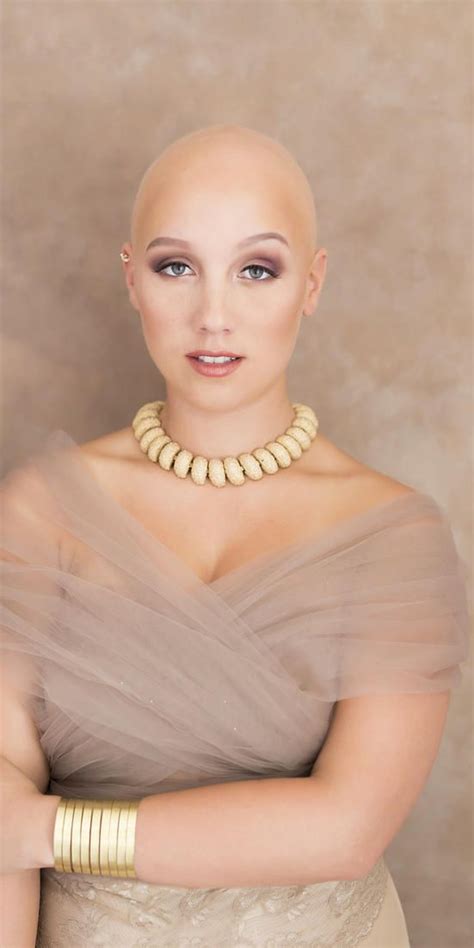 Meet The Inspiring Woman Embracing Her Alopecia, Even On Her Wedding Day | Shaved head women ...