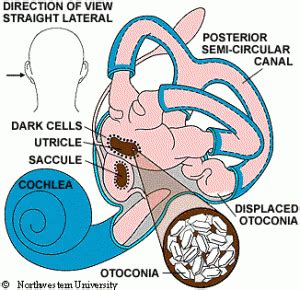 What is Benign Paroxysmal Positional Vertigo? - Vitamin Insider