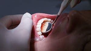 Gum Disease Treatment Phoenix | Periodontal Therapy | Smile Fitness Dental Center
