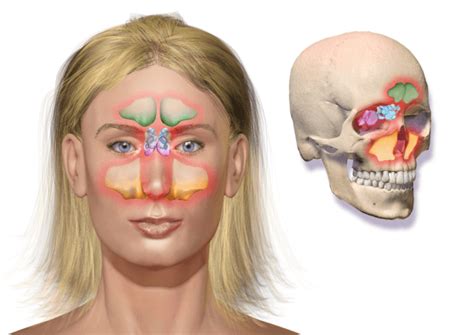 Sinonasal Tumor: Symptoms, Anatomy, Diagnosis and Treatment - Houston Advanced Sinus