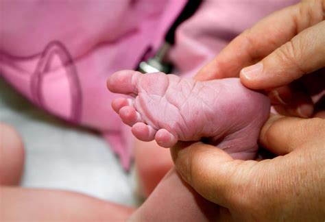 Babinski (Plantar) Reflex In Babies: Why It Happens & What to Do About It