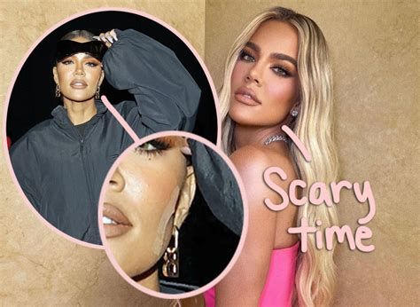 Khloé Kardashian Details Getting A TUMOR Removed From Her Face ...