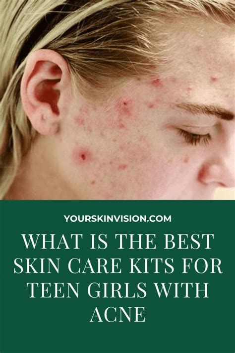 Best Skin Care Kits For Teen Girls With Acne In 2024