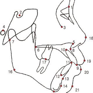 Angular measurements used in study (continued): 11, interincisal angle;... | Download Scientific ...