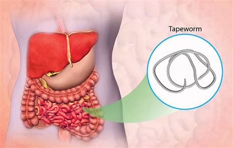 Health Condition : Symptoms, Causes, Treatment and More