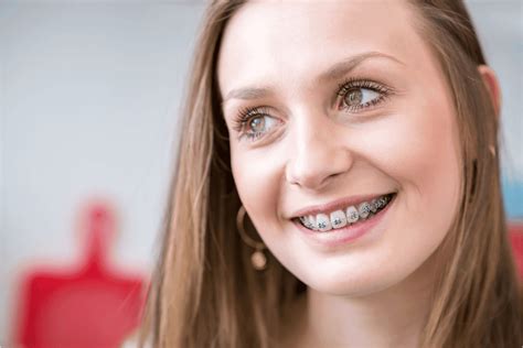 How Long Do Braces Take For Adults? — Legacy Orthodontics