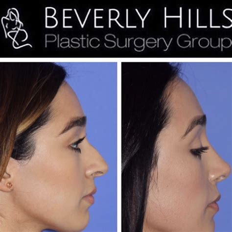 Beverly Hills Plastic Surgery Group - Beverly Hills, California - Realself