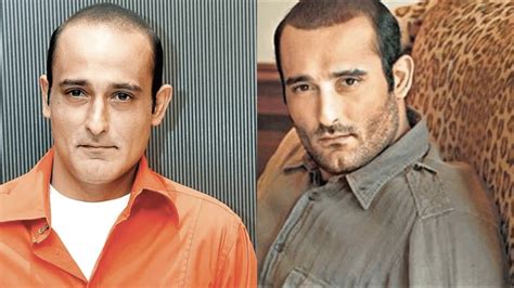 #10 Bollywood Actors Hair Transplant Story-Read Now