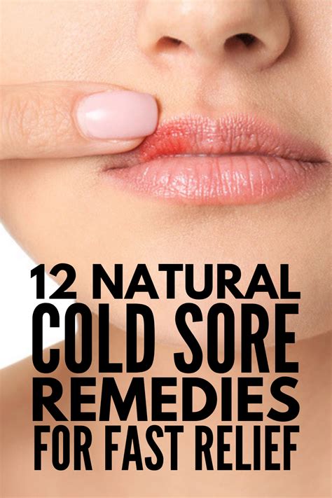 Natural Cold Sore Remedy, Healing Cold Sore, Natural Remedies, Lip Sore Remedy, Diy Cold Sore ...