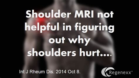 Why Your Shoulder MRI Results May Not Be Important... - Regenexx®