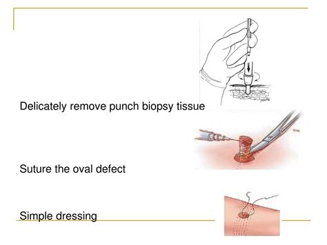 PPT - Punch biopsies for the Dermatological Nurse PowerPoint Presentation - ID:6319790