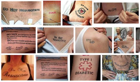 Update more than 73 can anesthesiologists have tattoos super hot - in ...