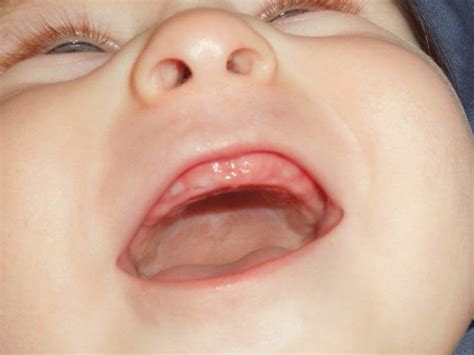 When Do Baby Teeth Come In? All You Ever Wanted To Know — Caring Parents` Choice