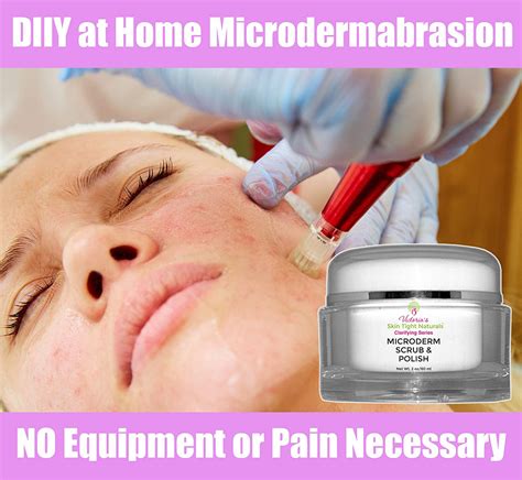 Microdermabrasion At Home - Skin Tight Naturals