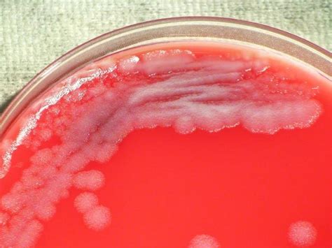 Bacillus Anthracis | howMed Images