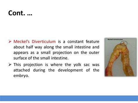 Avian Digestive System