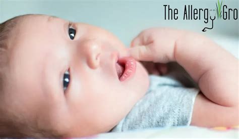 Babies & Food Allergies - Asthma & Allergy Clinic | Boise, Nampa, Eagle, Meridian, Caldwell