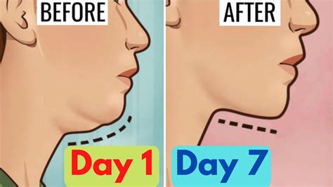 5 Best Double Chin Exercises for Men & Women | Get Rid of Double Chin Fast without SURGERY - YouTube