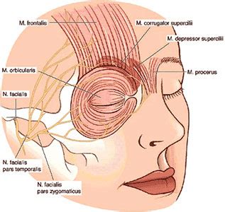 Migraine Procedure - Migraine Surgery Centre