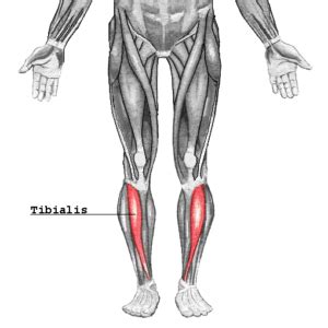 Circumduction gait: Causes, muscle weakness, treatment